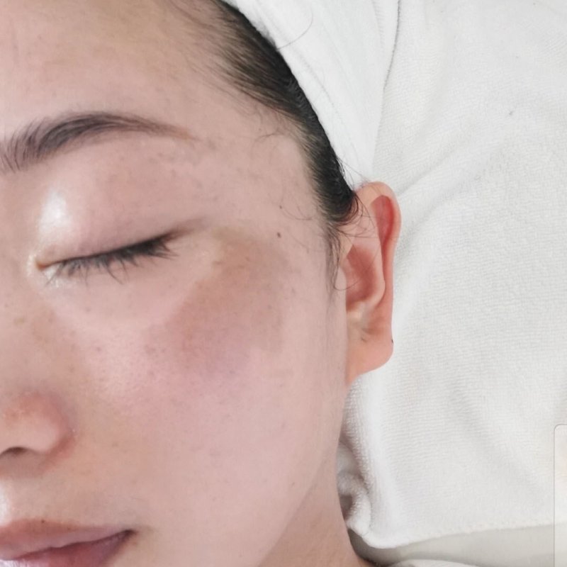 Brightening & Glow Facial — common symptoms
