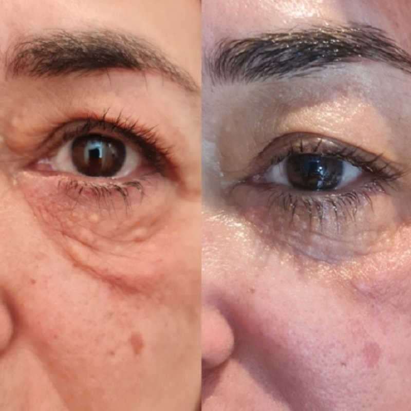 Firming & Skin Tightening — common symptoms