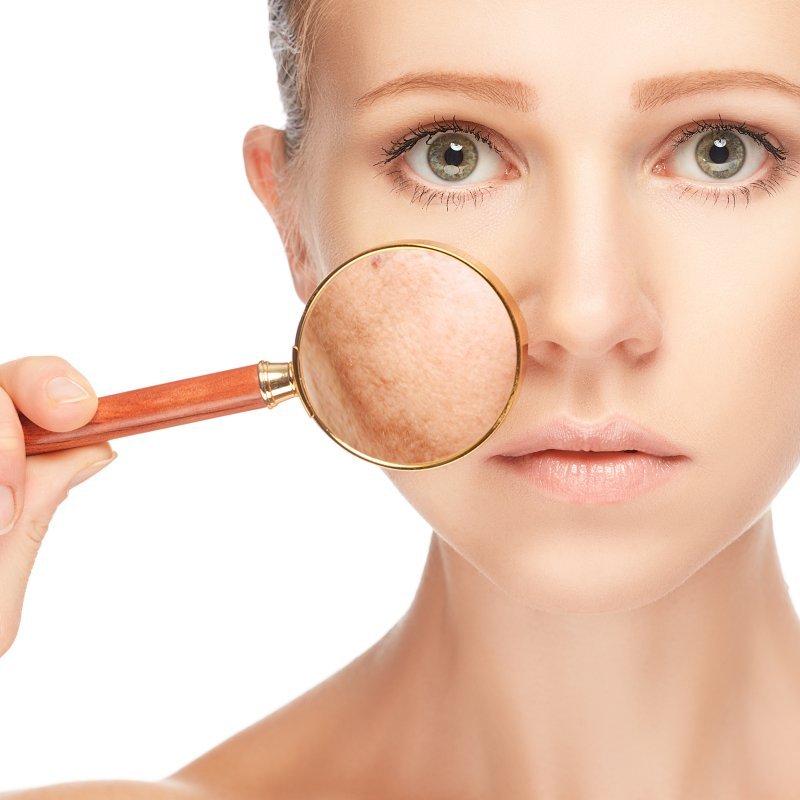 Post-Treatment Recovery Facial — common symptoms